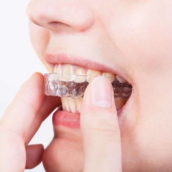 Behandlung zum Zahnerhalt