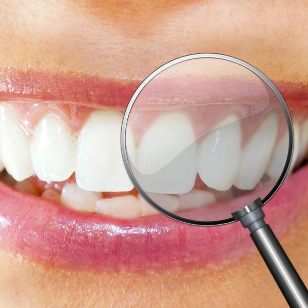 Behandlung zum Zahnerhalt