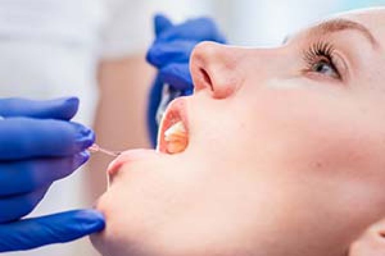 Behandlung zum Zahnerhalt